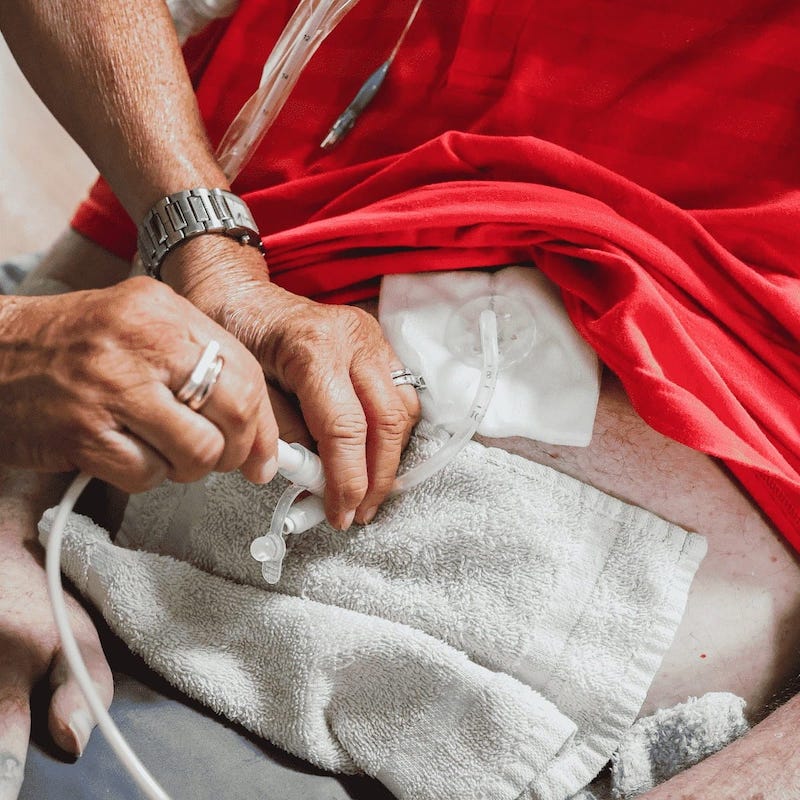 A caregiver helps with inserting a feeding tube.