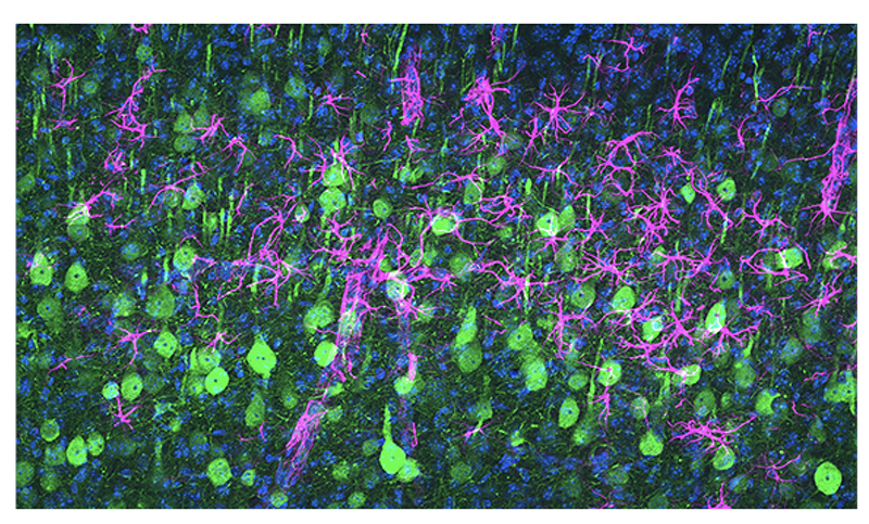The red/magenta cells are the astrocytes, which wrap around the diseased neurons and as the disease progresses they attack them.