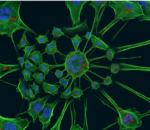 Looking at bridges between neurons for clues to ALS