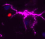 Connecting the immune system to ALS to develop new therapies